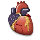 corazon